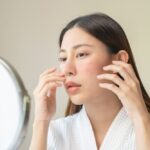 Barriera cutanea danneggiata