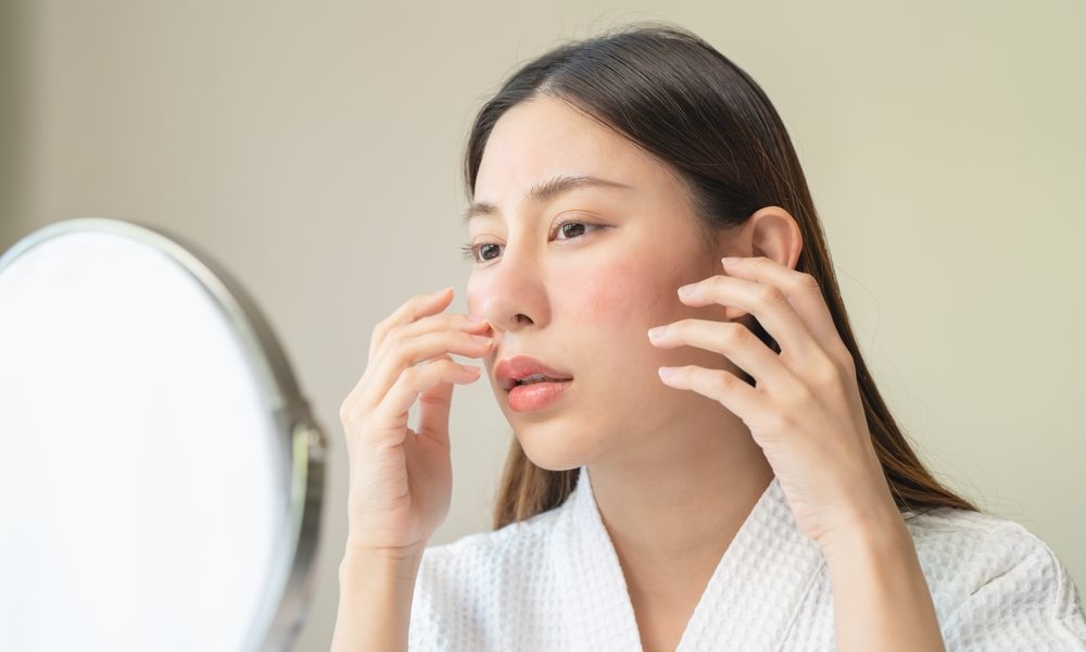 Barriera cutanea danneggiata